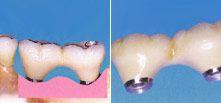 Leistungsspektrum Dentallabor (15)