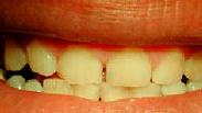 Leistungsspektrum Dentallabor (3)